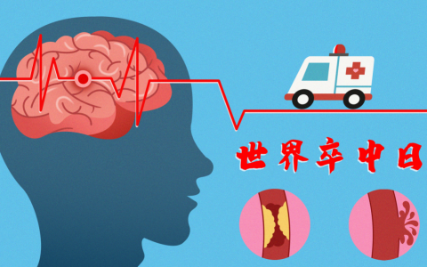 世界卒中日：识别中风症状 把握宝贵时间