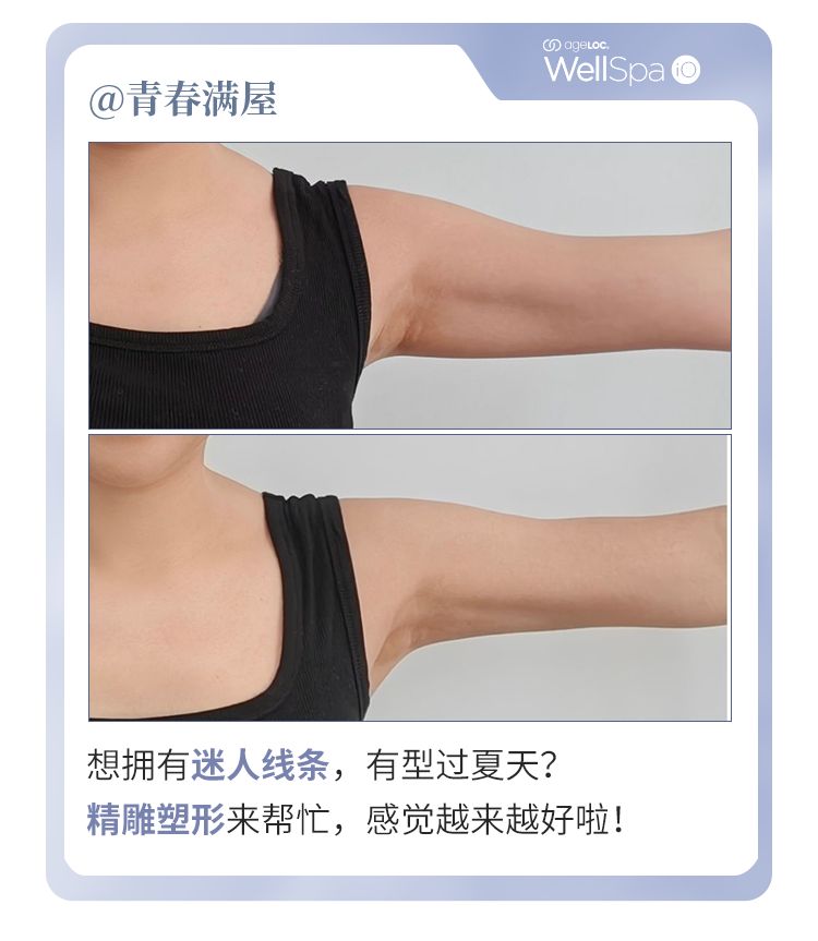 如新 | WellSpa iO 5分钟养生打卡挑战完美收官